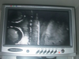 hyperbaric works (28)